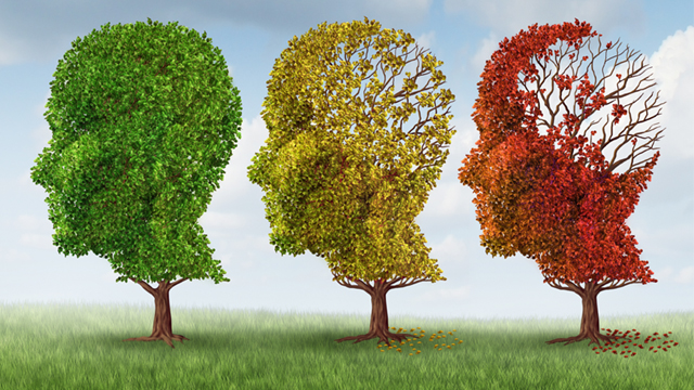 Imagem de Alzheimer: Constante estimulação cerebral pode evitar a doença