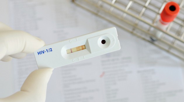 Imagem de Anvisa libera acesso ao autoteste de HIV