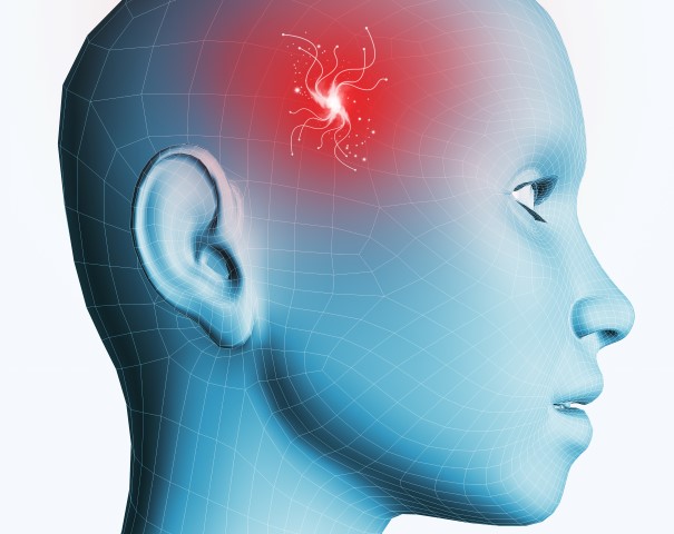 Imagem de Enxaqueca: saiba como identificar este problema