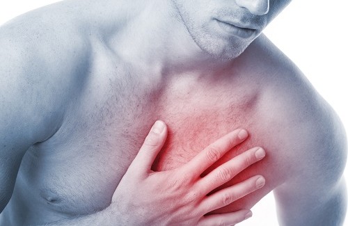 Imagem de Infarto: dor no peito não é único sinal