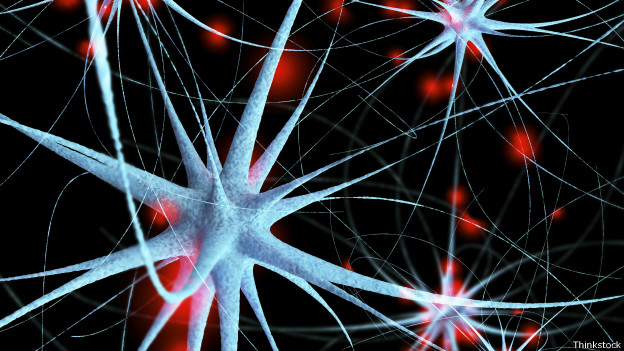 Imagem de Cientistas britânicos criam novo exame capaz de prever o Alzheimer
