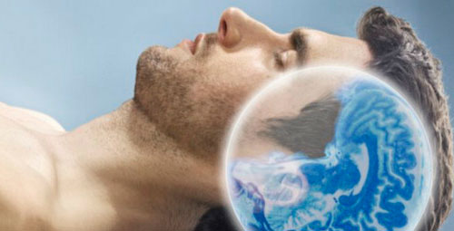 Imagem de Estudo revela que sono elimina toxinas no cérebro