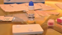 Imagem de Novos testes de HIV irão agilizar tratamento da Aids
