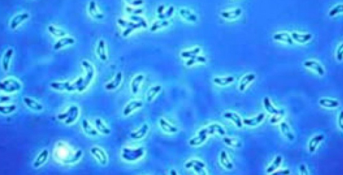 Imagem de Mais da metade dos brasileiros já tiveram contato com a toxoplasmose